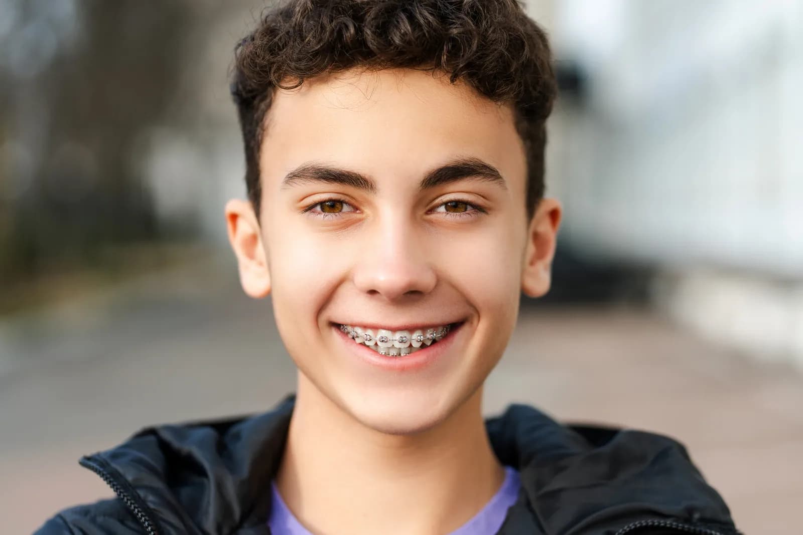 Traditional braces orthodontic treatment at London Square Dental Calgary